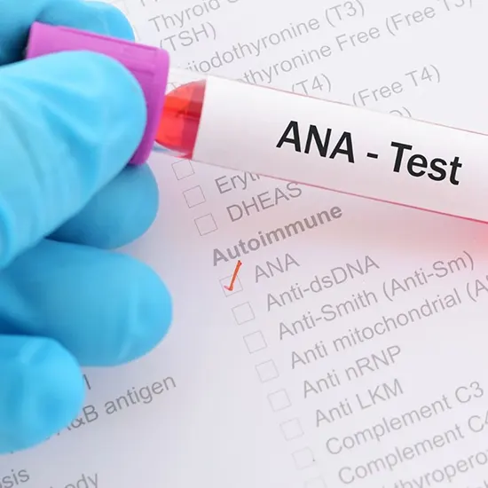 Antinuclear Antibody (ANA) Profile